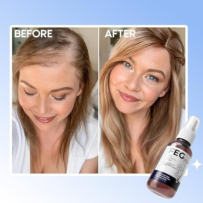 Hair Growth Spray | بخاخ نمو الشعر