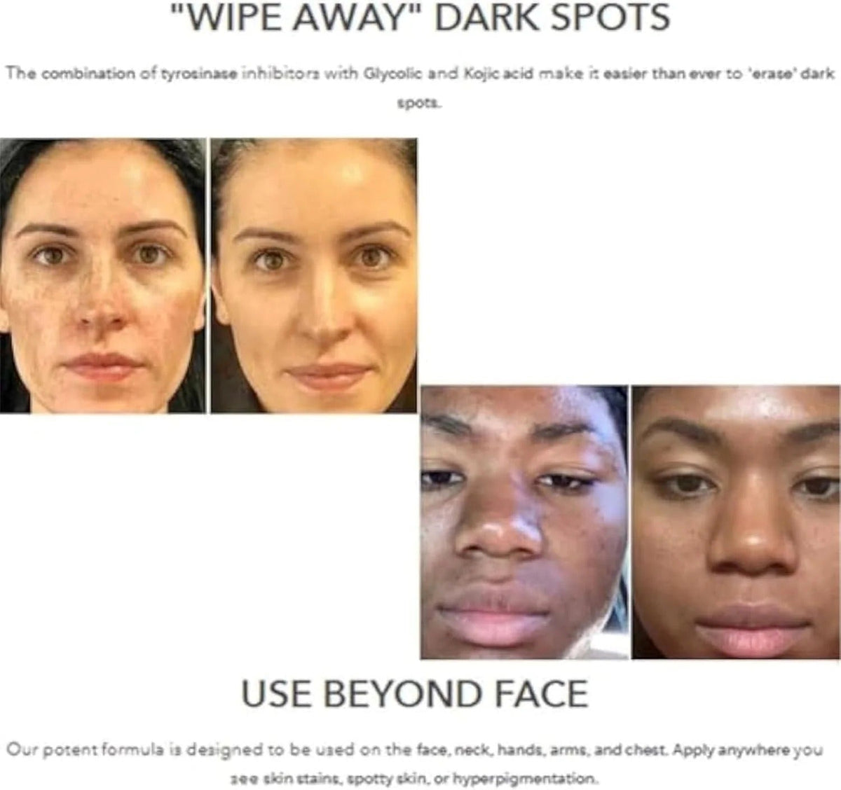 Hoygi Dark Spot Lotion | لوشن هويجي لتصبغات البشرة Dark Spot Lotion | لوشن هويجي لتصبغات البشرة