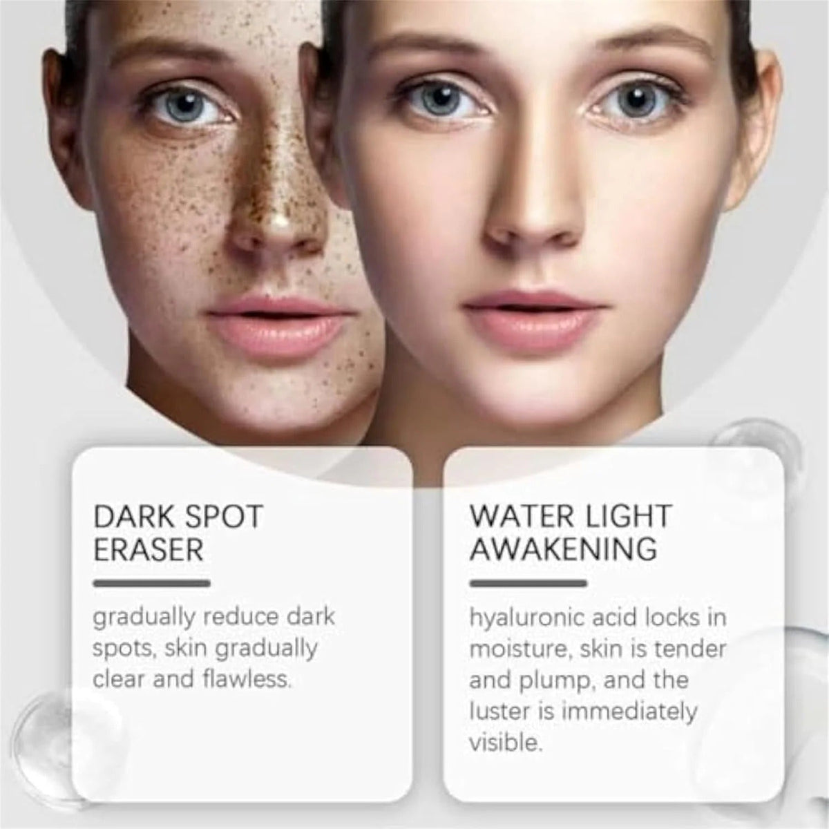 Hoygi Dark Spot Lotion | لوشن هويجي لتصبغات البشرة Dark Spot Lotion | لوشن هويجي لتصبغات البشرة
